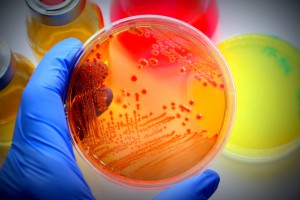 petri.dish  300x200 - 4 Things Travel Nurses Need to Know About Latest Superbug Gene